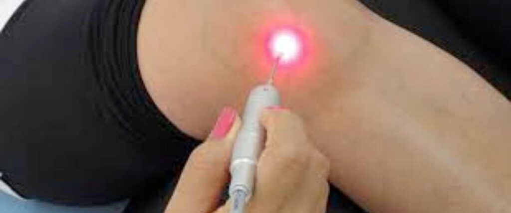 laserterapia tratamento
